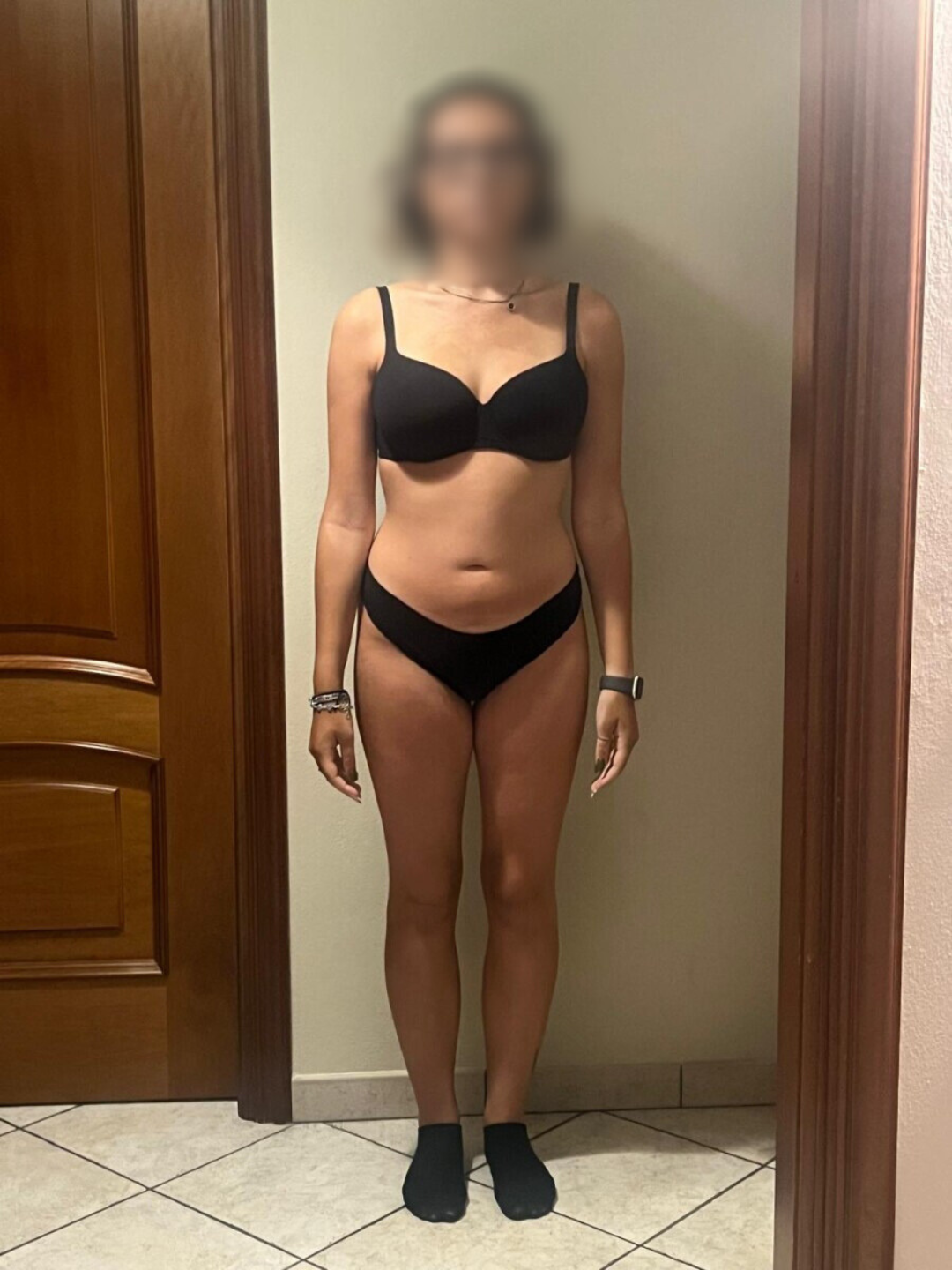 Dopo - Trasformazione di Alice